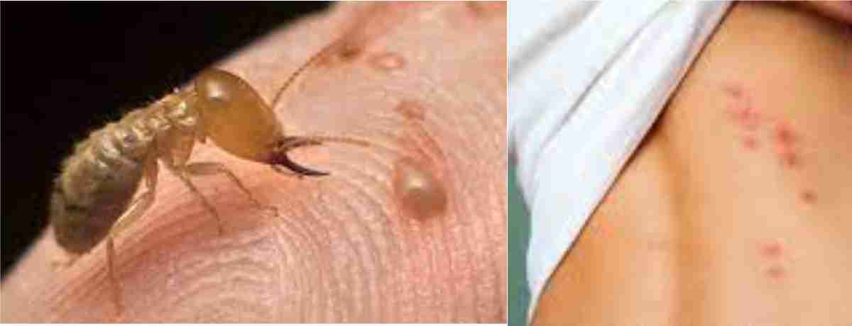 bị Mối cắn có độc không